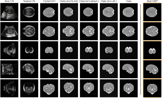 Figure 4 for Anatomy-Aware Self-supervised Fetal MRI Synthesis from Unpaired Ultrasound Images