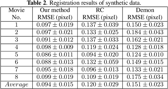 Figure 4 for A New Registration Approach for Dynamic Analysis of Calcium Signals in Organs