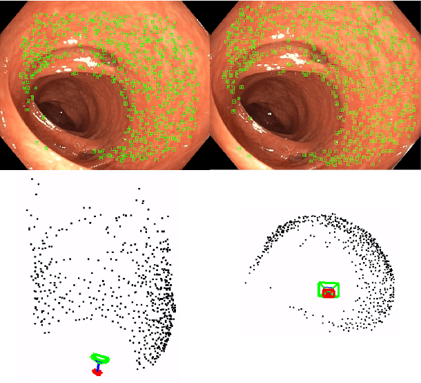 Figure 2 for Tracking monocular camera pose and deformation for SLAM inside the human body