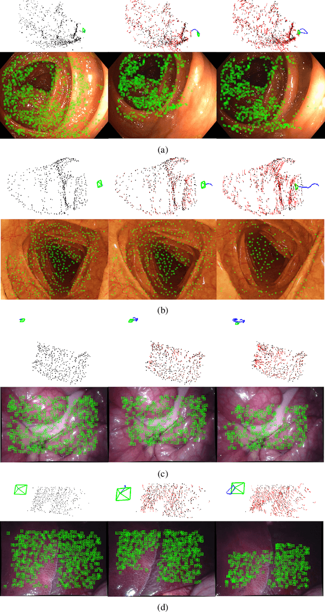 Figure 3 for Tracking monocular camera pose and deformation for SLAM inside the human body