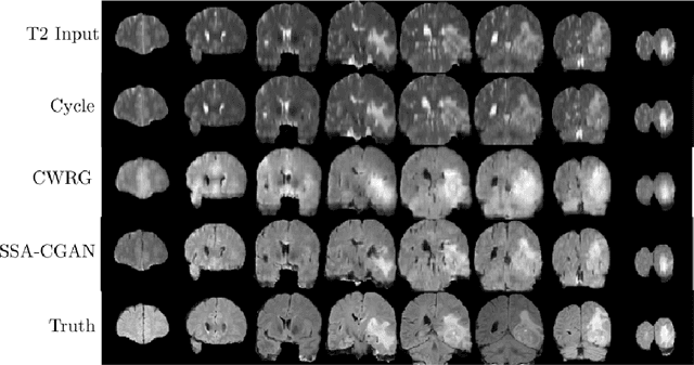 Figure 4 for Semi-supervised Learning Approach to Generate Neuroimaging Modalities with Adversarial Training