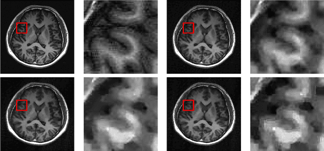 Figure 3 for Two-stage Geometric Information Guided Image Reconstruction