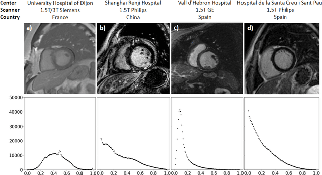 Figure 1 for Multi-center, multi-vendor automated segmentation of left ventricular anatomy in contrast-enhanced MRI
