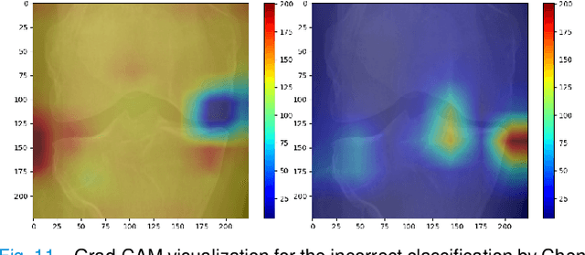 Figure 3 for Knee Osteoarthritis Severity Prediction using an Attentive Multi-Scale Deep Convolutional Neural Network
