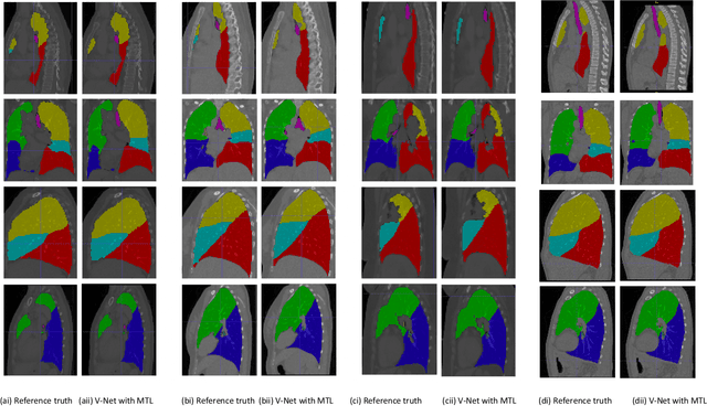 Figure 4 for Development of a Multi-Task Learning V-Net for Pulmonary Lobar Segmentation on Computed Tomography and Application to Diseased Lungs