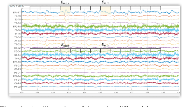 Figure 3 for Improved EEG Event Classification Using Differential Energy