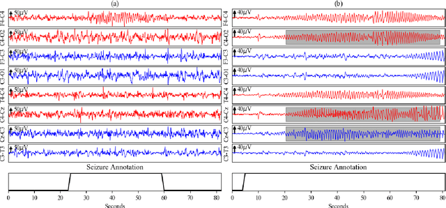 Figure 2 for Neonatal seizure detection from raw multi-channel EEG using a fully convolutional architecture