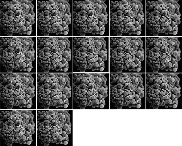 Figure 1 for Unsupervised automatic classification of Scanning Electron Microscopy (SEM) images of CD4+ cells with varying extent of HIV virion infection