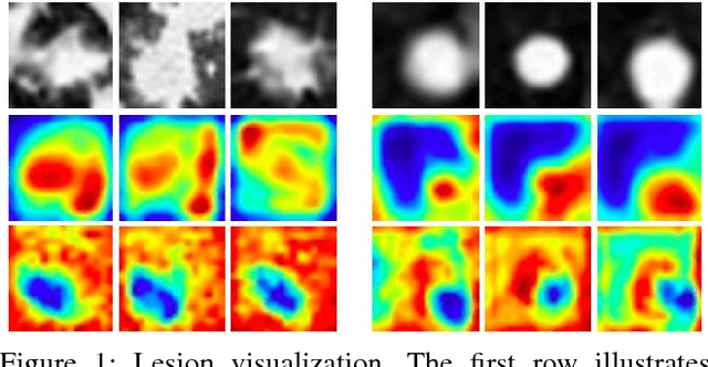 Figure 1 for Soft Activation Mapping of Lung Nodules in Low-Dose CT images