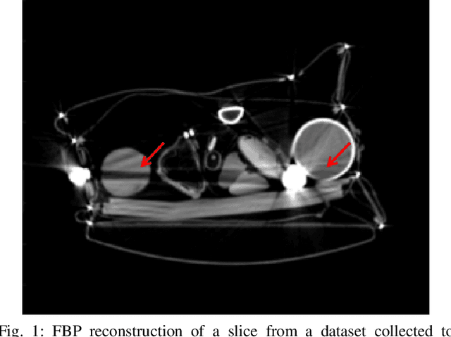 Figure 1 for Fast Accurate CT Metal Artifact Reduction using Data Domain Deep Learning
