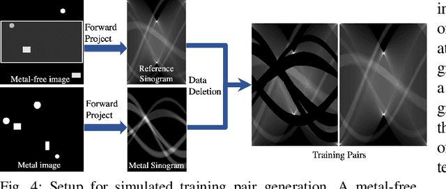 Figure 4 for Fast Accurate CT Metal Artifact Reduction using Data Domain Deep Learning