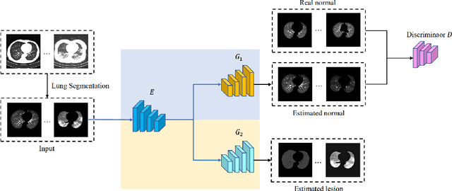 Figure 1 for Towards Unbiased COVID-19 Lesion Localisation and Segmentation via Weakly Supervised Learning