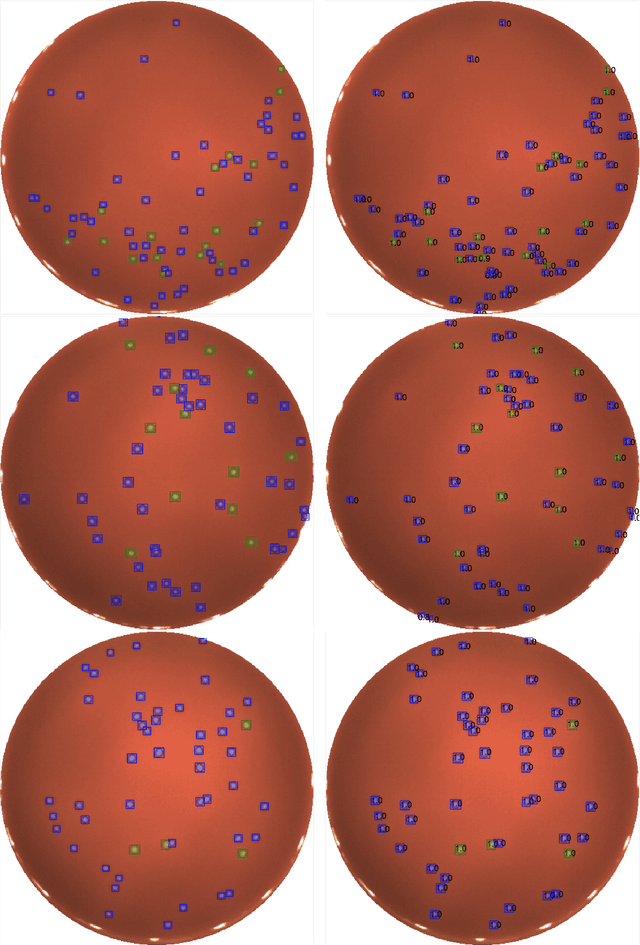 Figure 4 for A Mask R-CNN approach to counting bacterial colony forming units in pharmaceutical development