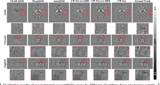 Figure 3 for Reconstruction of Quantitative Susceptibility Maps from Phase of Susceptibility Weighted Imaging with Cross-Connected Ψ-Net