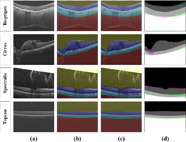 Figure 2 for Automated segmentation and extraction of posterior eye segment using OCT scans