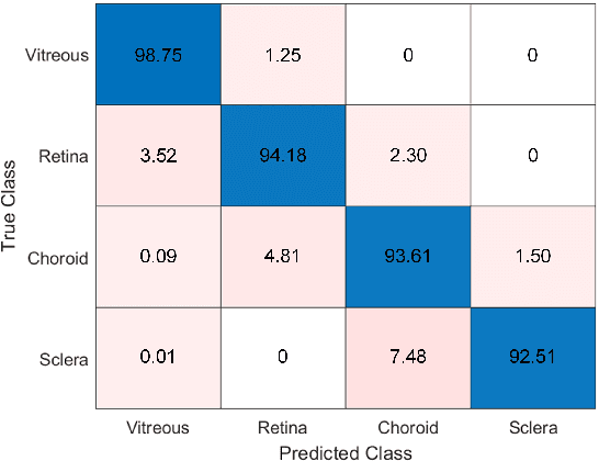 Figure 4 for Automated segmentation and extraction of posterior eye segment using OCT scans