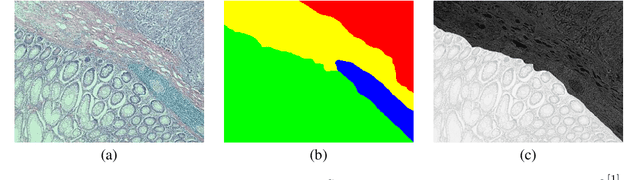 Figure 2 for Image Embedded Segmentation: Combining Supervised and Unsupervised Objectives through Generative Adversarial Networks