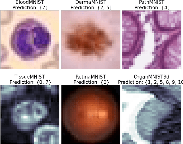 Figure 1 for Distribution-Free Federated Learning with Conformal Predictions