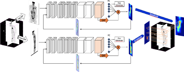 Figure 3 for Weakly Supervised PET Tumor Detection Using Class Response