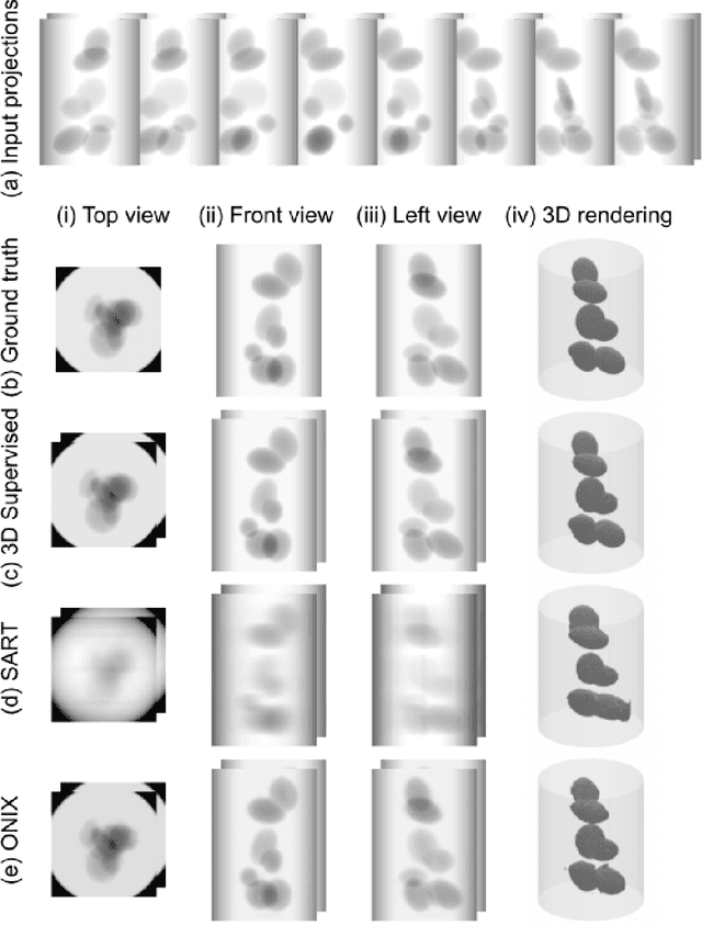 Figure 4 for ONIX: an X-ray deep-learning tool for 3D reconstructions from sparse views