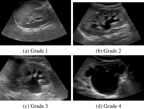 Figure 1 for Unsupervised Medical Image Segmentation with Adversarial Networks: From Edge Diagrams to Segmentation Maps