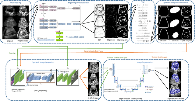 Figure 3 for Unsupervised Medical Image Segmentation with Adversarial Networks: From Edge Diagrams to Segmentation Maps