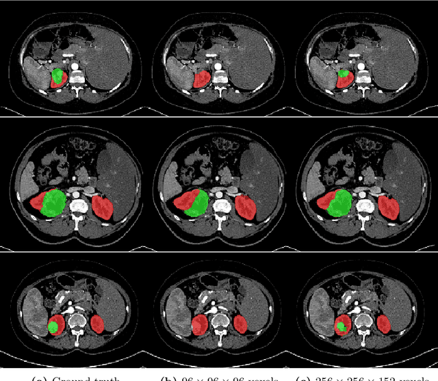 Figure 4 for Organ Segmentation From Full-size CT Images Using Memory-Efficient FCN