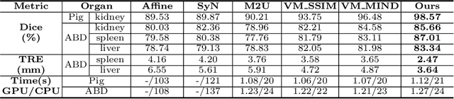 Figure 4 for Adversarial Uni- and Multi-modal Stream Networks for Multimodal Image Registration