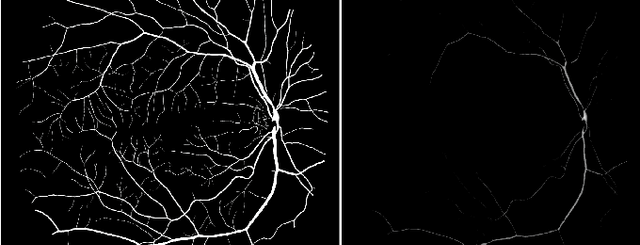 Figure 2 for An Unsupervised Method for Detection and Validation of The Optic Disc and The Fovea