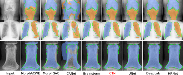 Figure 3 for Learning to Segment Anatomical Structures Accurately from One Exemplar