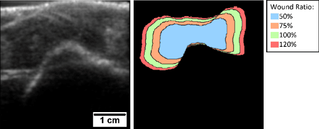 Figure 1 for Initial Investigations Towards Non-invasive Monitoring of Chronic Wound Healing Using Deep Learning and Ultrasound Imaging