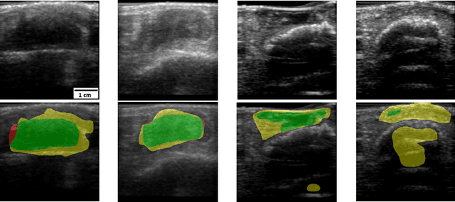 Figure 3 for Initial Investigations Towards Non-invasive Monitoring of Chronic Wound Healing Using Deep Learning and Ultrasound Imaging