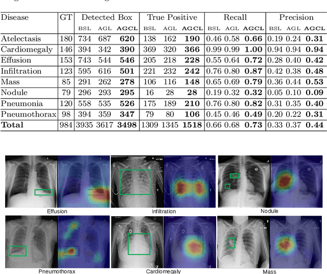 Figure 4 for Attention-Guided Curriculum Learning for Weakly Supervised Classification and Localization of Thoracic Diseases on Chest Radiographs