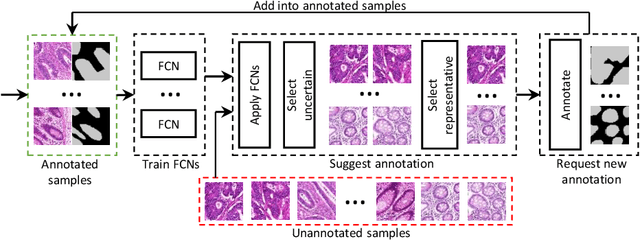 Figure 1 for Suggestive Annotation: A Deep Active Learning Framework for Biomedical Image Segmentation