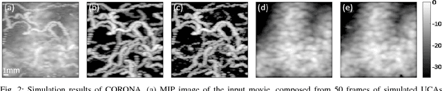 Figure 2 for Deep Unfolded Robust PCA with Application to Clutter Suppression in Ultrasound
