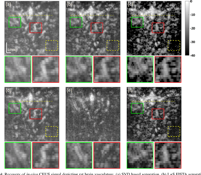 Figure 4 for Deep Unfolded Robust PCA with Application to Clutter Suppression in Ultrasound