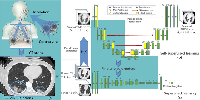 Figure 4 for Learning from Pseudo Lesion: A Self-supervised Framework for COVID-19 Diagnosis