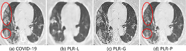 Figure 2 for Learning from Pseudo Lesion: A Self-supervised Framework for COVID-19 Diagnosis