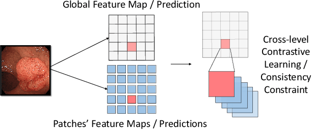 Figure 1 for Cross-level Contrastive Learning and Consistency Constraint for Semi-supervised Medical Image Segmentation