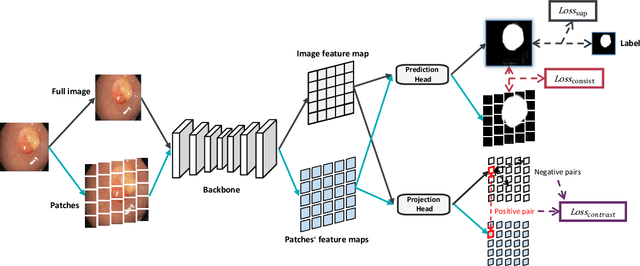 Figure 3 for Cross-level Contrastive Learning and Consistency Constraint for Semi-supervised Medical Image Segmentation