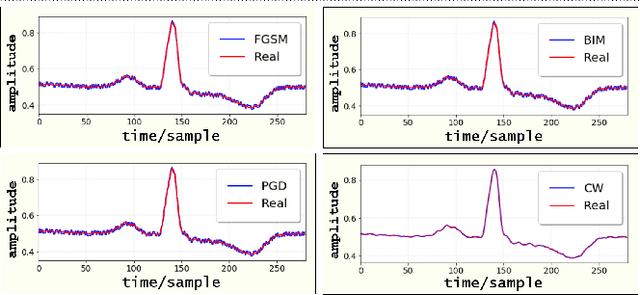 Figure 3 for ECG-ATK-GAN: Robustness against Adversarial Attacks on ECG using Conditional Generative Adversarial Networks