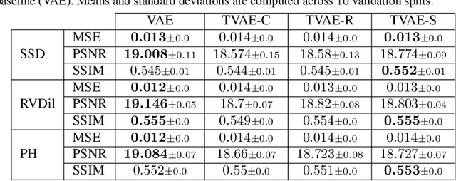 Figure 2 for Interpretable Anomaly Detection in Echocardiograms with Dynamic Variational Trajectory Models