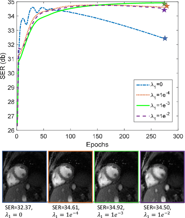 Figure 3 for Dynamic Imaging using Deep Bi-linear Unsupervised Regularization (DEBLUR)