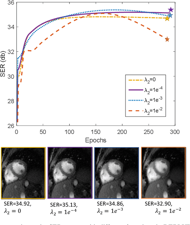 Figure 4 for Dynamic Imaging using Deep Bi-linear Unsupervised Regularization (DEBLUR)