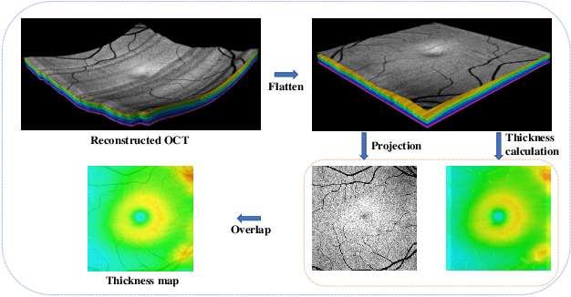 Figure 3 for COROLLA: An Efficient Multi-Modality Fusion Framework with Supervised Contrastive Learning for Glaucoma Grading