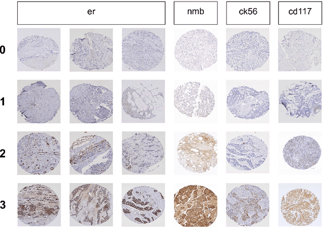 Figure 4 for Automatically Score Tissue Images Like a Pathologist by Transfer Learning
