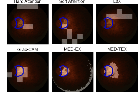 Figure 3 for MED-TEX: Transferring and Explaining Knowledge with Less Data from Pretrained Medical Imaging Models