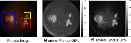 Figure 4 for MED-TEX: Transferring and Explaining Knowledge with Less Data from Pretrained Medical Imaging Models