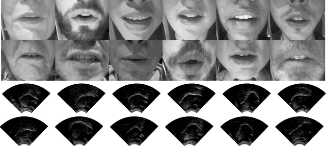 Figure 4 for TaL: a synchronised multi-speaker corpus of ultrasound tongue imaging, audio, and lip videos