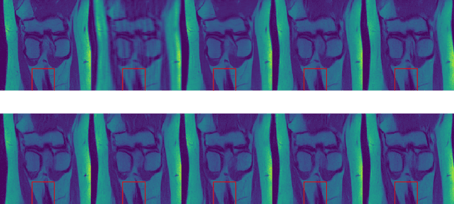 Figure 1 for Denoising Score-Matching for Uncertainty Quantification in Inverse Problems